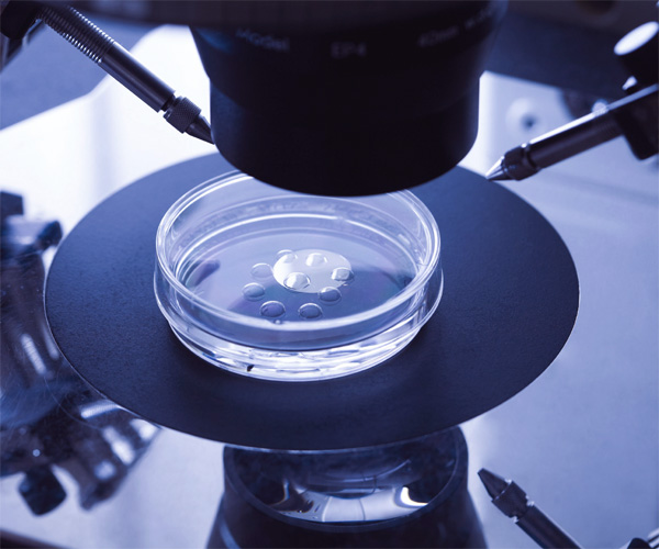 In Vitro Fertilization